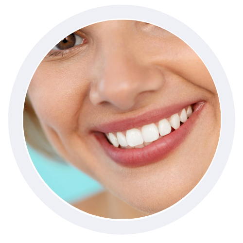 kit blanqueamiento dental